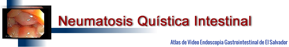 Neumatosis Quistica Intestinal
